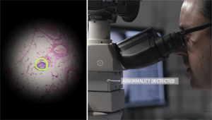 “Ağıllı” “Google” mikroskopu xərçəngi diaqnozlaşdırmağa kömək edəcək