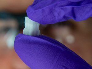 İnsan bədənində ən mürəkkəb toxumalardan birinin 3D implantı hazırlanıb