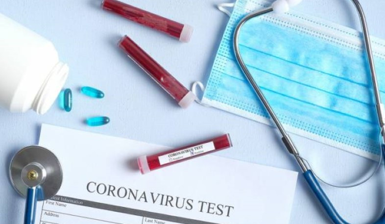 Azərbaycanda daha 1 477 nəfər koronavirusa yoluxub, 21 nəfər ölüb - FOTO