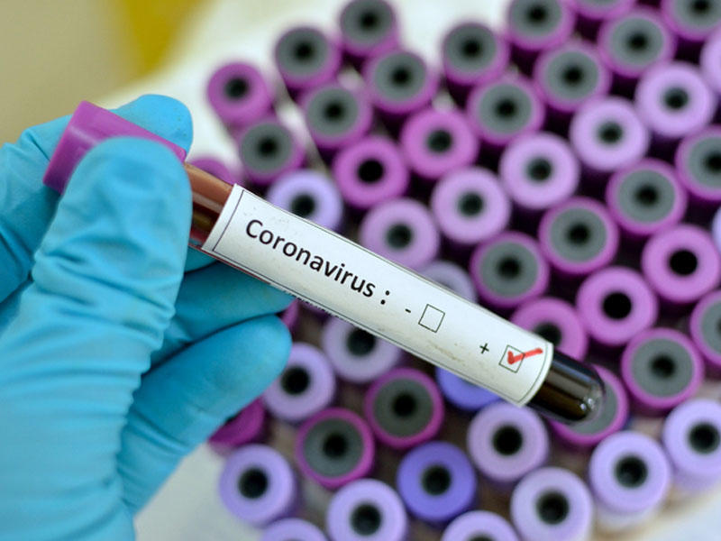 Koronavirusa qarşı vaksinin sınaqdan keçiriləcəyi tarix açıqlandı