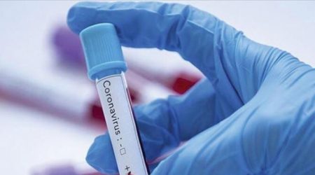 Azərbaycanda daha iki nəfər koronavirusdan öldü: 379 yeni yoluxma - RƏSMİ+VİDEO